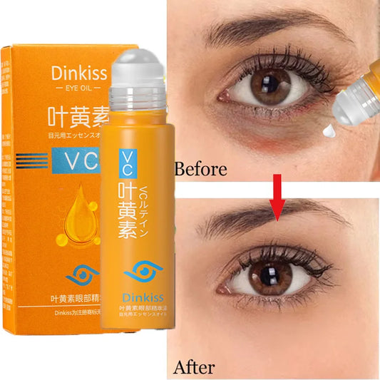 Anti Dark Circle Eye Serum Oil Retinol Anti Wrinkle.